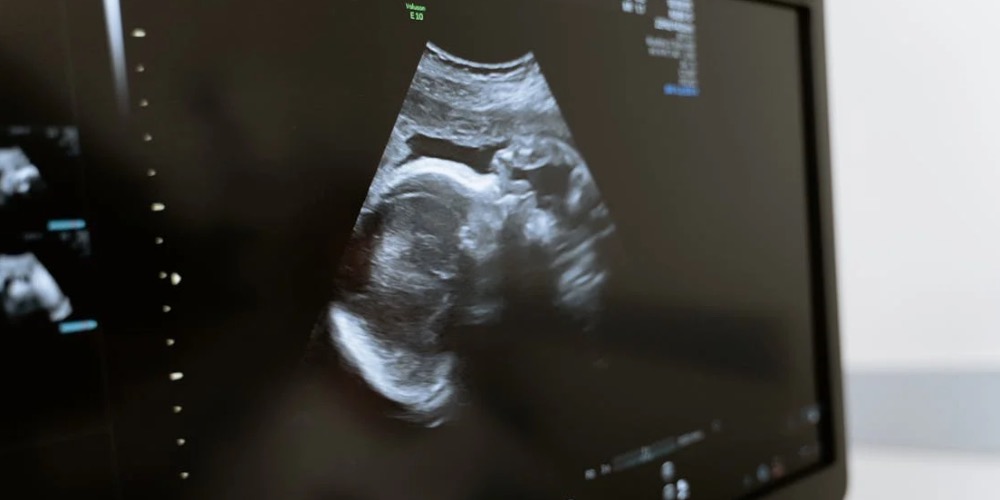 A termékenység támogatása Ayurvédával